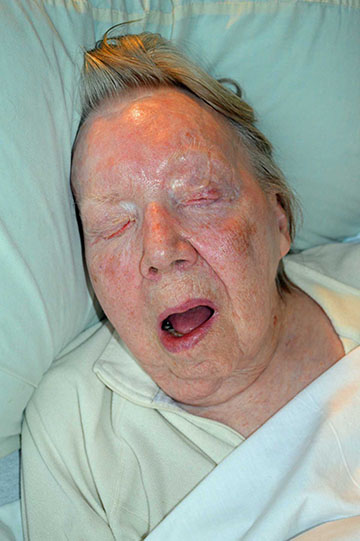 Beverly, resting in comfort